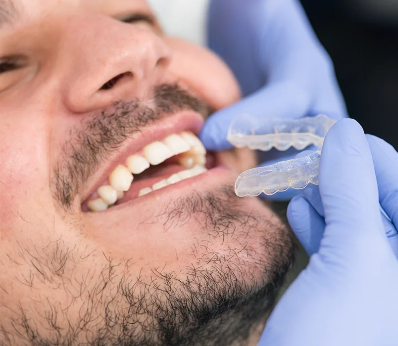 Dentisterie restauratrice