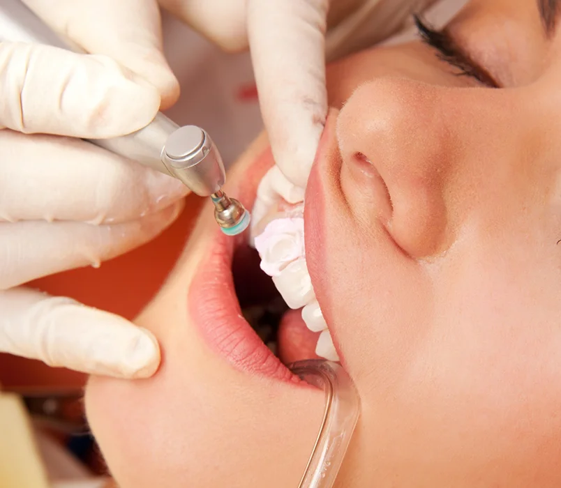 Endotontie Jessica Quitard dentiste Paris 9 Endotontie Jessica Quitard dentiste Paris 9