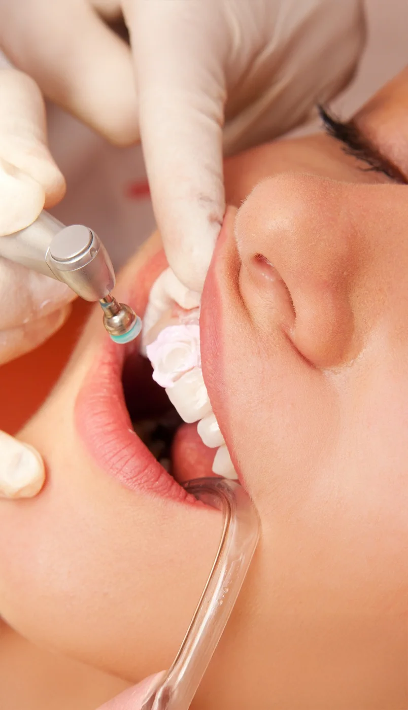 Endotontie dentiste Paris 9
