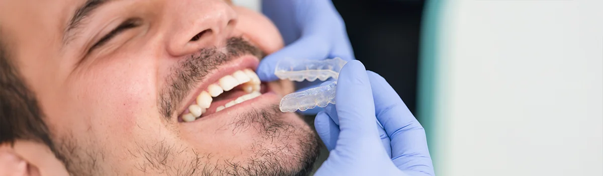 Parodontologie – Prenez soin de vos gencives pour préserver vos dents