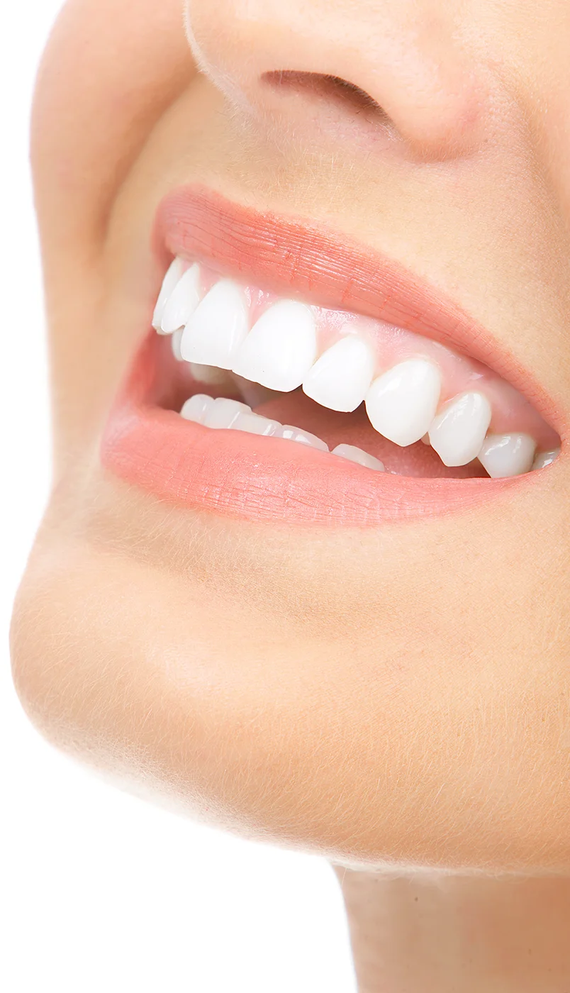 Parodontologie – Soins dentiste Paris 9 Parodontologie - Soins dentiste Paris 9