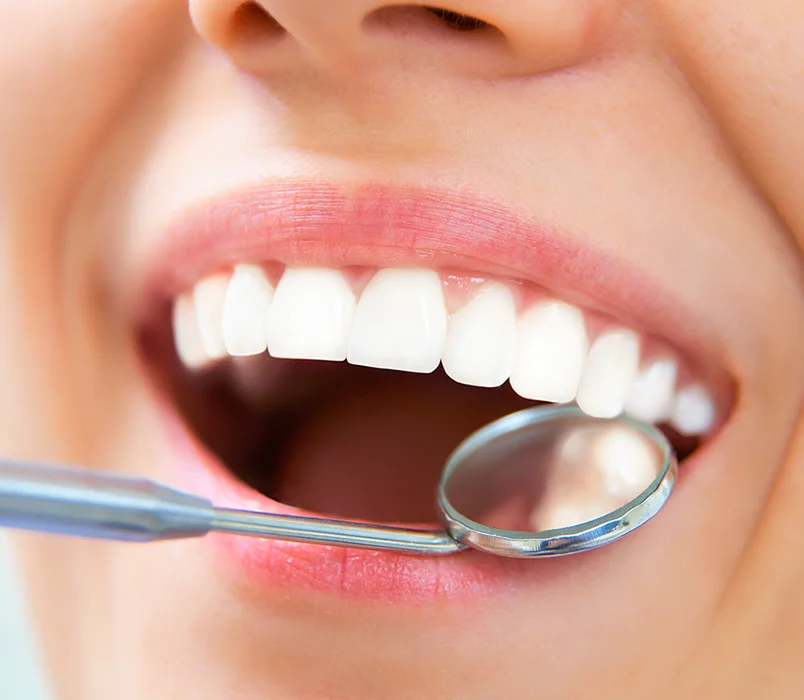 Soins dentaires : Endodontie